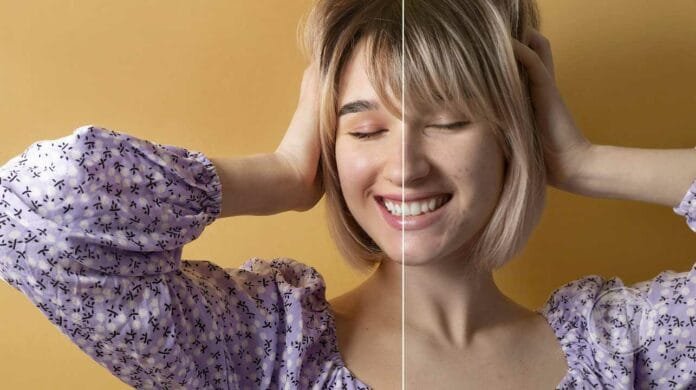 Makeup Glamour:Cover Every Type of Acne