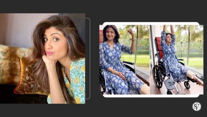 Shilpa Shetty breaks leg